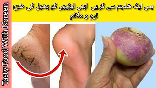 Phati Ariyan Ka ilaj  | Best Home Made Remedy for Cracked Heels | Phati Ariyan Se Chutkara