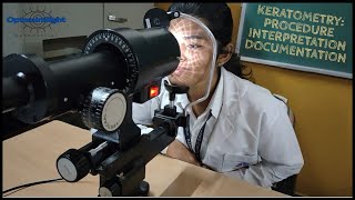 Keratometry: Procedure, Interpretation & Documentation Explained