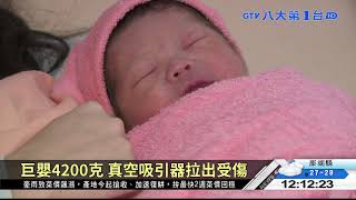 巨嬰出生即骨折 產婦怒告要求償 八大民生新聞 2021081005