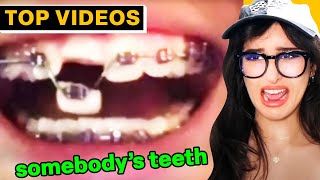 All Your WORST PAINS In One Video  [MUST SEE!] | SSSniperWolf