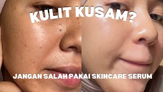 KULIT KUSAM? MERAPATTT | ONESKIN SERUM REVIEW JUJUR