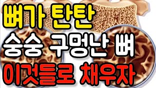 숭숭 구멍 난 뼈 이것 먹으면 탄탄하게 꽉 채워진다 : 골다공증을 위한 영양소와 생활습관들! : good food for osteoporosis