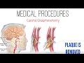 Stroke: Treatments