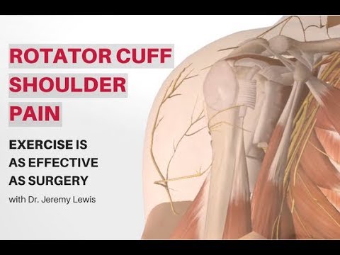 Rotator Cuff Shoulder Pain: Exercise is as effective as surgery. Rotator Cuff Shoulder Pain: Exercise is as effective as surgery.