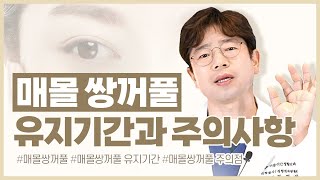 매몰법 쌍꺼풀의 유지기간과 주의점