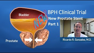 New BPH treatment clinical trial Part 1: Prostate Stent