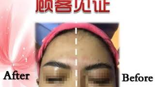 EPI 脸穴经络疏通护理 Meridian Facial Treatment