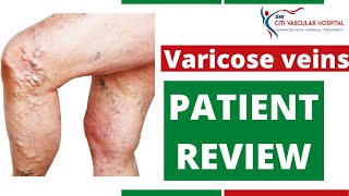 Varicose veins Happy Patient Review | Happy Patient After Varicose veins Surgery