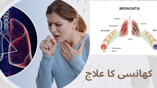 cough treatment in Homeopathic /Homeo Dr Adnan 03007893940