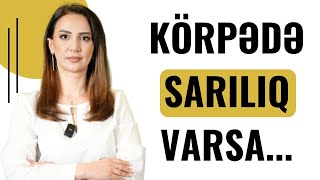 Yenidoğulan Körpələrdə SARILIQ Xəstəliyi