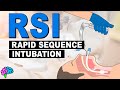 What is Rapid Sequence Intubation (RSI)?