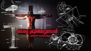 ഒരാളെ ക്രൂശിലേറ്റുമ്പോൾ എന്താണ് സംഭവിക്കുക ? | Crucifixion - A Medical Point of View | Malayalam