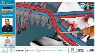 Innovation in Damage Control Resuscitation For Elderly Trauma Patient