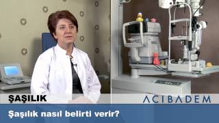 Şaşılık nasıl belirti verir ?