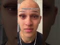 How are we feeling about woman Nicolas? #comedy #funny #relatable #alopecia