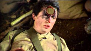 WKUK Battle Wounds HD