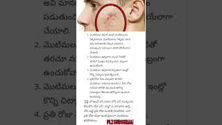 అందం చిట్కాలు home రెమిడీస్#youtubeshorts#health#shortvideo#youtube#beauty#beautytips