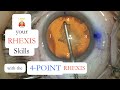 LEVEL-UP your RHEXIS!  Tips to improve your capsulorhexis skills.