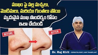 మృదువైన చర్మం కోసం | Best Way To get Soft Skin | Get Rid Of Open Pores And Blackheads | Dr Raj Kirit