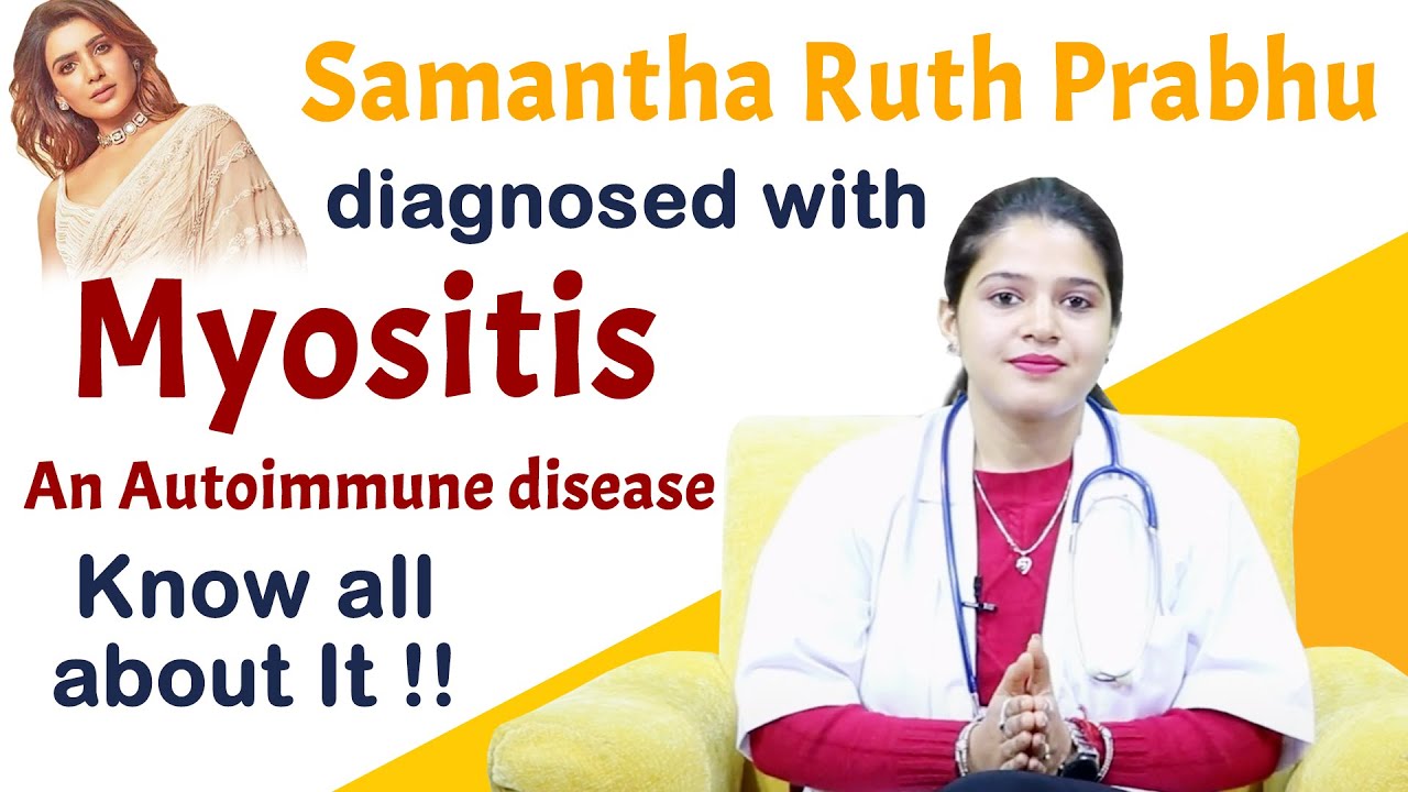 Samantha Ruth Prabhu Diagnosed With Myositis - An Autoimmune Disease ...