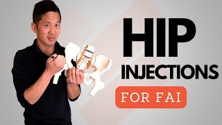 Hip Pain, Hip Injections, and Hip Impingement Surgery