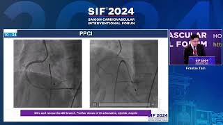 SIF 2024  - Room 2 -  Session 1 -  STEMI & ACS PCI cases