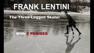 Frank Lentini: The Three-Legged Skater W. Subs | Untold Stories & Forgotten Memories #truestory