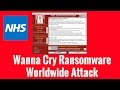 Wanna Cry Ransomware Worldwide Attack