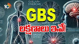 GBS Symptoms | GBS Cases Filed In AP | GBS లక్షణాలు ఇవి | 10TV