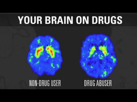 How addiction changes your brain How addiction changes your brain