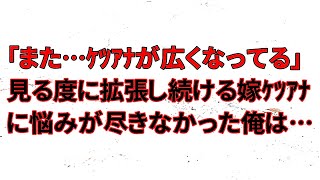 【修羅場】俺「まただ…ケ〇アナが広くなってる」見る度に拡張し続ける嫁ケ〇アナに悩みが尽きなかった俺は…