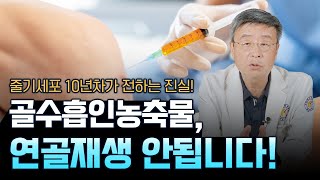 [연세사랑병원] 골수흡인농축물 효과, 연골재생이 아닙니다! 줄기세포 10년차가 전하는 진실!