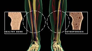 A Look Inside the Body with Life Line Screening