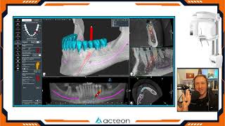 Acteon AIS3D 5.4 Lower Arch Demo