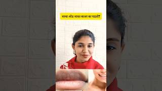 हिवाळ्यात ओठांची काळजी कशी घ्यावी नक्की बघा#मराठी#lipcare #youtubemarathi#shortsfeed #wintercaretips