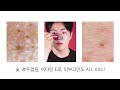 리르rire 블랙헤드는 누구에게나 있어요 all kill blackhead project