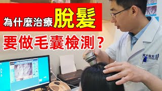 【脫髮常識】為什麼治療脫髮前一定要做毛囊檢測？對症下藥才能有效恢復！雍禾植髮|李丙雙醫生