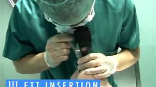 Airtraq Optical Laryngoscope - Demonstration