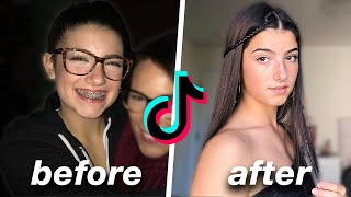 famous tiktok stars before and after