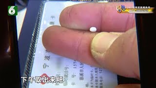 【1818黄金眼】孩子耳朵不舒服，全麻手术才取出异物