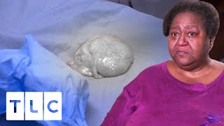 "This Is A Lipoma Jackpot!" | Dr. Pimple Popper Pop Ups