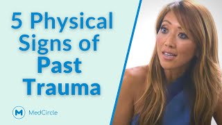 5 Physical Signs of Past Trauma That Most People Miss