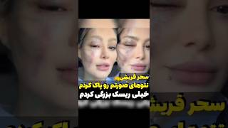 سحر قریشی: تتوهای صورتم رو پاک کردم، خیلی درد کشیدم...نظر شما چیه؟ #سحرقریشی #تتلو #امیر_تتلو