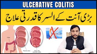 ULCERATIVE COLITIS | Anton Ki Sozish Ka ilaj | Bari Ant ki Sozish ki Alamat