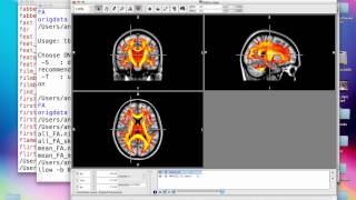 DTI Analysis, Steps 6\u00267: TBSS (Part 2)