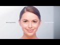 new ultraformer iii cartridges to treat all facial wrinkles