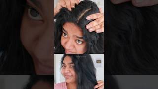 മുടി തഴച്ചു വളരാൻ 🔥 #haircare #hairgrowth #hair #dandruff