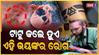 ଟାଟୁ କଲେ ରହିଛି ଜୀବନ ପ୍ରତି ବିପଦ | Tattoo Side Effects | Breaking News | ZEE7 ODIA