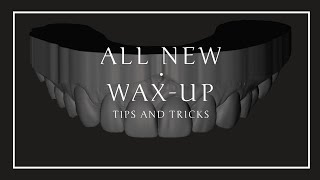 ALL NEW! Digital Diagnostic Wax-up Tutorial (for InLab/CEREC users)