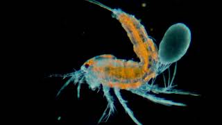 Copepod of the order Harpacticoida with eggs in darkfield